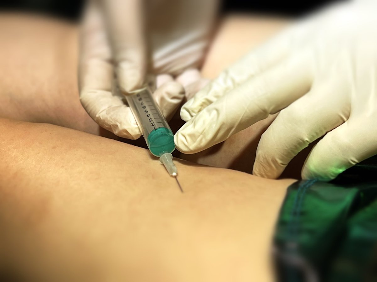 Dan Lei from Kinkclub in Denmark carried out two wonderful workshops in #BDSMkastellet during the international #BDSMday. One of them was about needle play, an edge play practice which isn’t for everyone.

Dan taught the eager crowd how to inject fluids under the skin to create