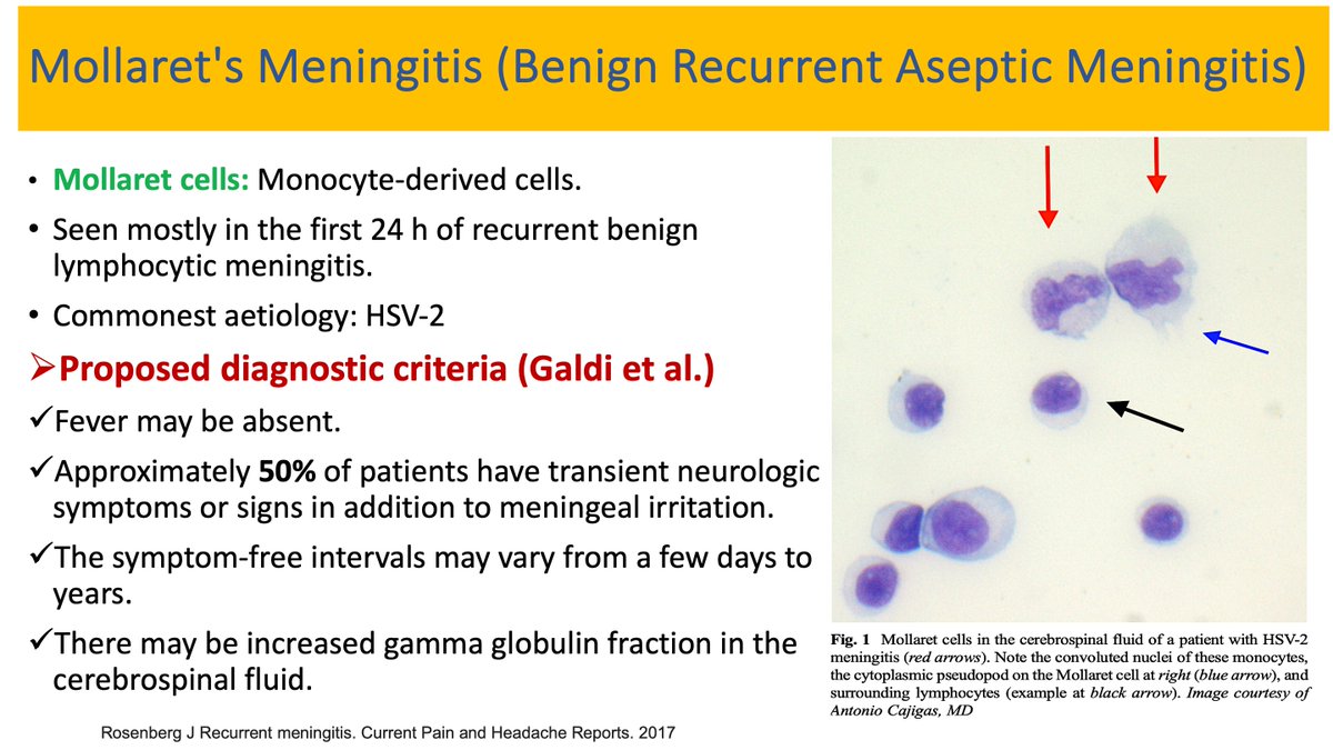 #IDtwitter #IDMedEd
Mollaret's Meningitis- Recurrent, brief episodes of meningitis followed by spontaneous recovery with symptom-free intervals