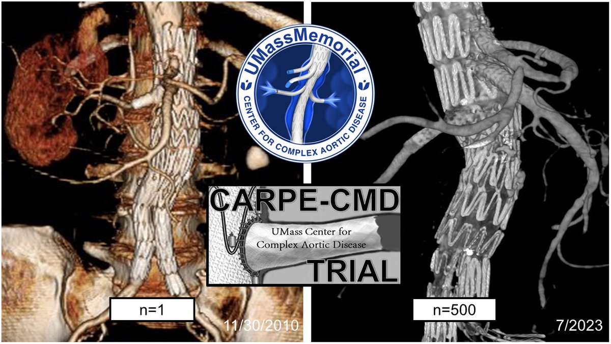 UMassVascular tweet media