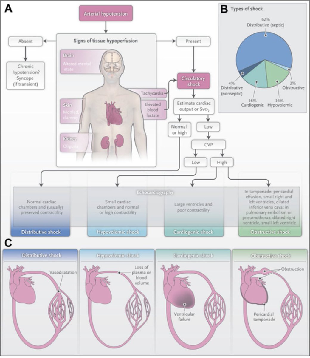 VSLanziotti's tweet photo. Nice review about #shock!
✅Diagnosis
✅Management
❗️Septic
❗️Hypovolemic
❗️Cardiogenic
❗️Obstructive
❗️Distributive
Worth read it! Thanks for sharing @nelsonSpinto
#sepsis #MedEd #FOAMed #Foacc
Important content for #fellows
https://t.co/JyvRbPelfv
@rjabornisky @drzaf_pic https://t.co/67iC5LKVkn