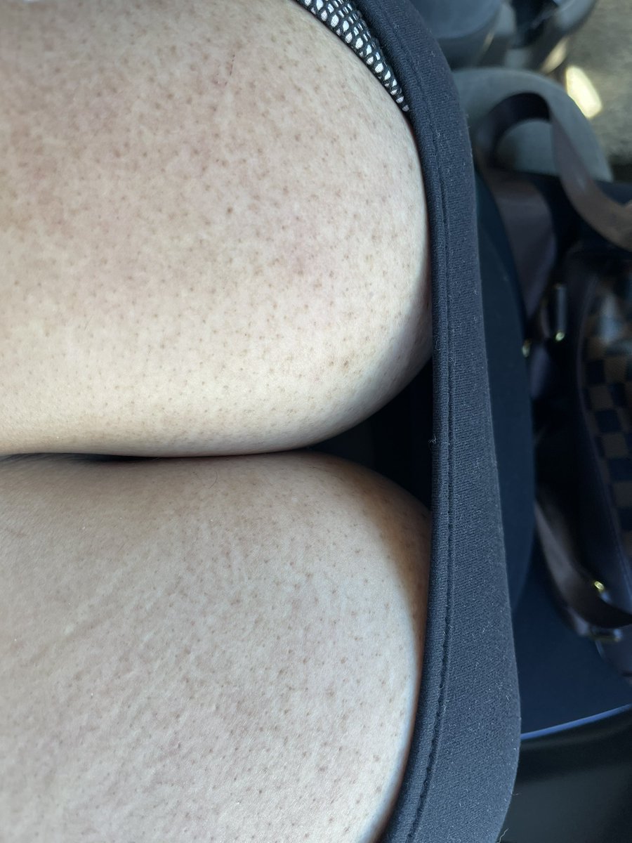 MaskedEgoddess's tweet photo. My view is amazing 🍒🤤
#naturalbreasts #naturalboobs #bigbouncy #softboobs #titfetish #cleavagefetish #cleavage 

https://t.co/o7mklOlTU7 https://t.co/TzKC5RugKT