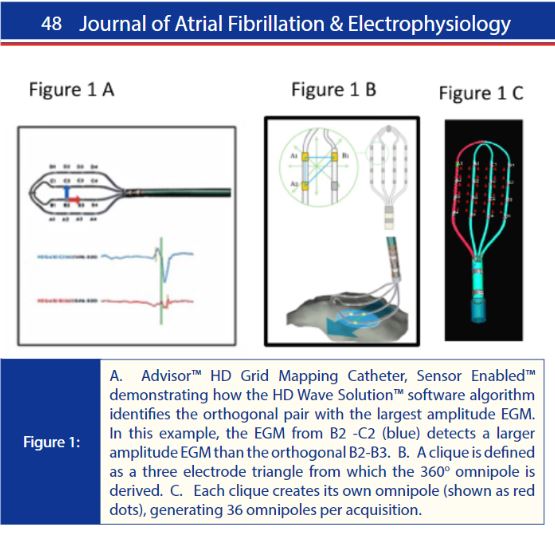 EPLive2's tweet photo. RT @jafib_EP Advisor HD Grid Mapping Catheter, Sensor Enabled™ and EnSite™ Omnipolar Technology: Their Role in Complex Arrhythmia Mapping https://t.co/3mYq5qcZtO @abbottcardio https://t.co/HcGHN0wzxl