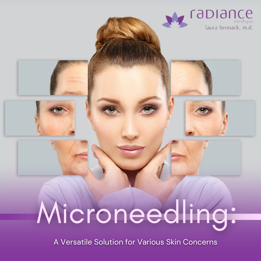radiancemed's tweet photo. This cutting-edge treatment stimulates collagen production, improves texture, and enhances the overall appearance of your skin.

Book a consultation today! ✨

☎️ (210) 804-0772
https://t.co/DTc8izDVr9

#DrLauraBennack #RadianceMedSpa #RadianceSanAntonio #MicroneedlingMagic https://t.co/Glv89MEsx7