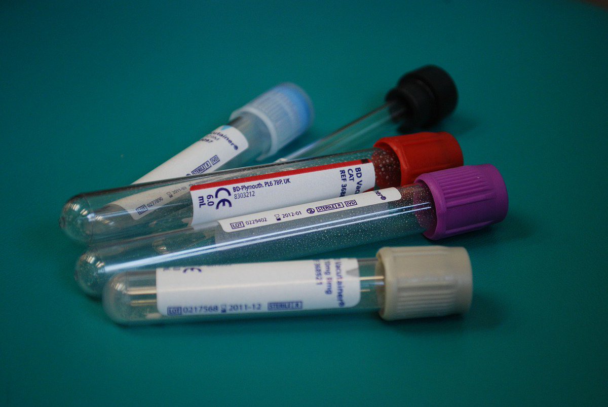 iansprostate's tweet photo. 6 years cancer free next month, and @ianrmayer PSA (Prostate Specific Antigen) level is 0.13 nanograms per millilitre! Thank you 👍💉 @SheffieldHosp #LocalGP #BloodTest #RARP #CancerSurvivor #ProstateCancer https://t.co/97Rnam3WfK