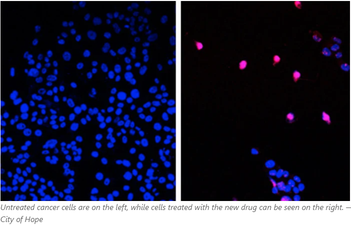 3syncR's tweet photo. Incredible breakthrough from Professor Linda Malkas: her drug selectively targets the modified form of PCNA found in cancer cells, allowing us to effectively stop cancer cell growth!  #CancerResearch #Breakthrough #MedicalAdvances #Oncology

https://t.co/YUmmodIuDZ https://t.co/UlBLkOpZ2m
