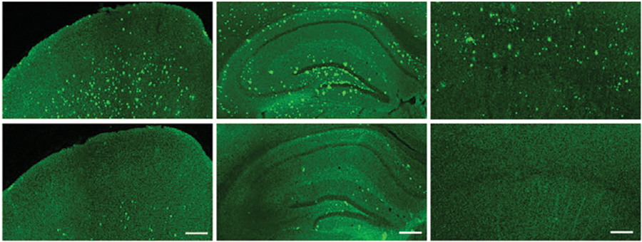 Alzforum (@alzforum) on Twitter photo Silencing a liver enzyme suppressed amyloid and tau pathology in the brains of two #alzheimersdisease mouse models. <a href="/SZUniversity/">Shenzhen University</a> ow.ly/y2E050PrgAE Silencing a liver enzyme suppressed amyloid and tau pathology in the brains of two #alzheimersdisease mouse models. <a href="/SZUniversity/">Shenzhen University</a> ow.ly/y2E050PrgAE