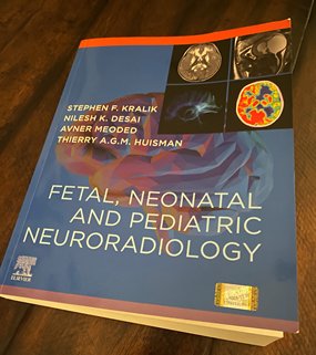 New book on fetal, neonatal and pediatric neuroradiology from Texas Children's Hospital, Department of Neuroradiology
shop.elsevier.com/books/fetal-ne…