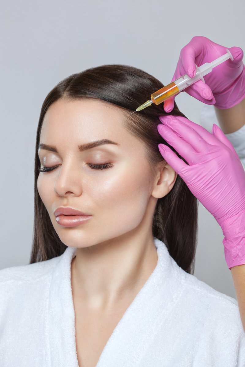 SmoothSynergy's tweet image. Platelet-Rich Plasma (PRP) has rocked the world, as one of the top non-surgical hair restoration treatments. But get set to take it up a notch! Today, we’re talking Platelet-Rich Fibrin or PRF. It’s very similar to PRP but with important differences: tinyurl.com/mr94ztdk