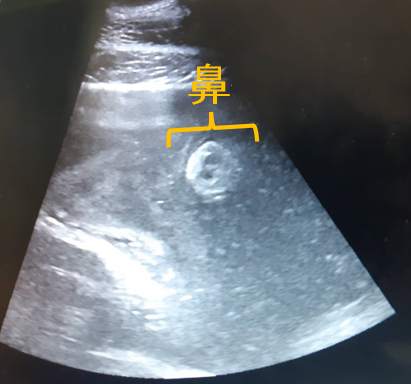 アジアゾウ「パール」について、本日、状態が安定しているときに腹部エコー（超音波）検査を実施したところ、はっきりと元気な胎仔が確認できました。画像で鼻の穴が確認できます。 city.sapporo.jp/zoo/03doubutsu…
