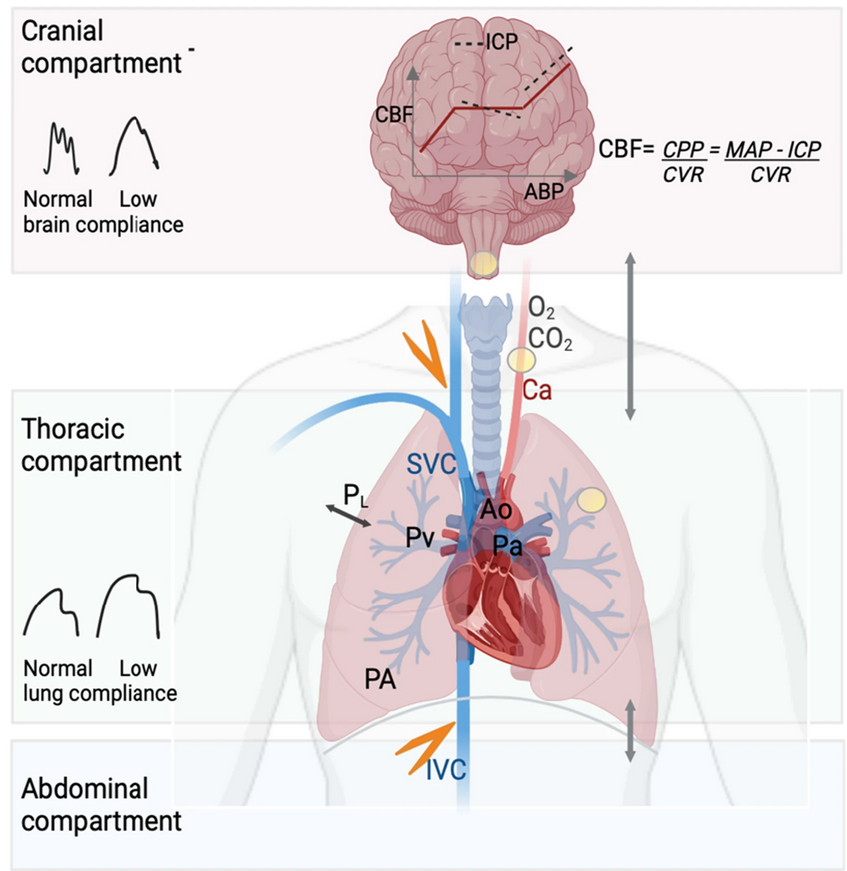 CritCareReviews's tweet photo. Today's paper of the day is by S. Frisvold on respiratory challenges and ventilatory management in different types of acute brain-injured patients

https://t.co/JKgcYjlUQ5
Join us to read 1 paper per day and stay up-to-date as we cover the spectrum of critical care across 2023 https://t.co/DfQ0qNVGT3