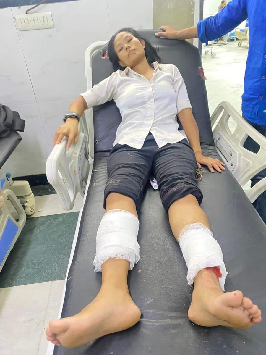 हिरासतमा लगेर निर्घात कुटपिट गर्न पाइन्छ,सरकार? 
हिजोको आन्दोलनमा भएको दमनमा राज्यको नश्लीय चिन्तन प्रष्ट देखिन्छ। न्याय र आत्मसम्ममानको पक्षधरता नारामा मात्र सीमित??
नेसपाका के.स. नेरुता मोक्तान, मञ्जु मिक्चान लगायत घाइते सबैमा शीघ्र स्वास्थ्यलाभको कामना। संघर्षमा सँगै छौं✊🏽✊🏽