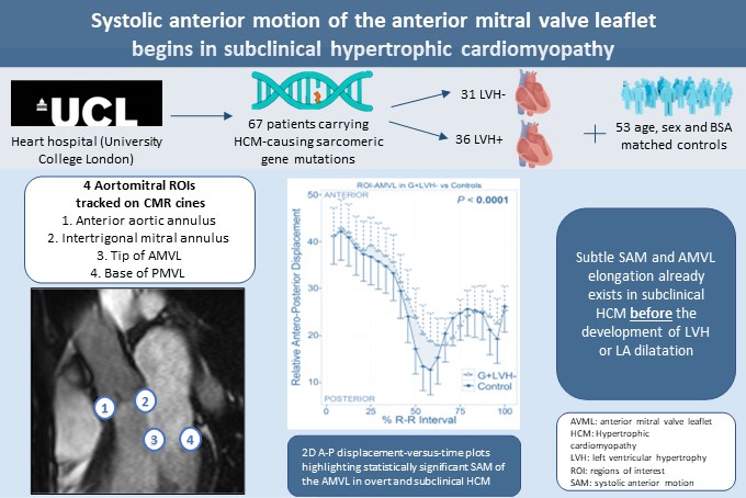 sdseitler's tweet photo. 🌟 Excited to share our new research 🌟 

🫀 Subclinical mitral valve abnormalities detectable in Hypertrophic Cardiomyopathy on #CMR 🧲

📖 https://t.co/IZ9nzuhJ3H

With thanks to @gabycaptur &amp; @suranidezoysa  

#CVimaging #EHJCVI  #CardioTwitter 
@GeraldMaurer @ESC_Journals https://t.co/B6BJxeG0KD