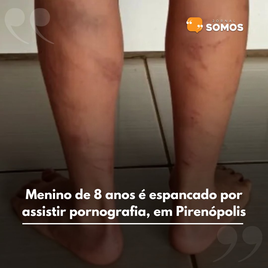 JornalSomos's tweet image. jornalsomos.com.br/goias/detalhe/…

#menino #espancado #lesões #pai #mãe #Pirenopolis #Goias
