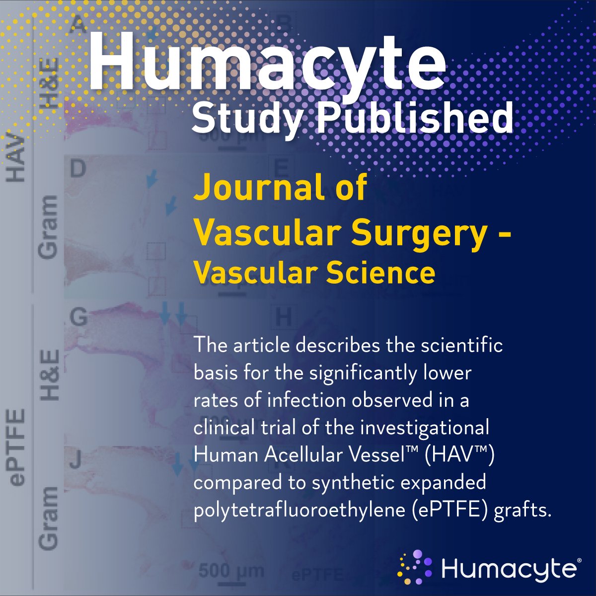 We’re proud to share a new study published in @JVS_VascSci describing the scientific basis for the significantly lower rates of infection observed in a clinical trial of our investigational HAV™ compared to synthetic expanded polytetrafluoroethylene (ePTFE) grafts.