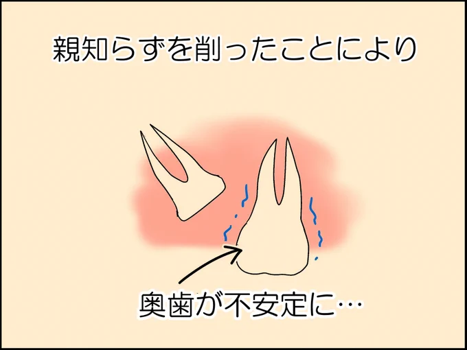 親知らずが飛んだ話 3/8 