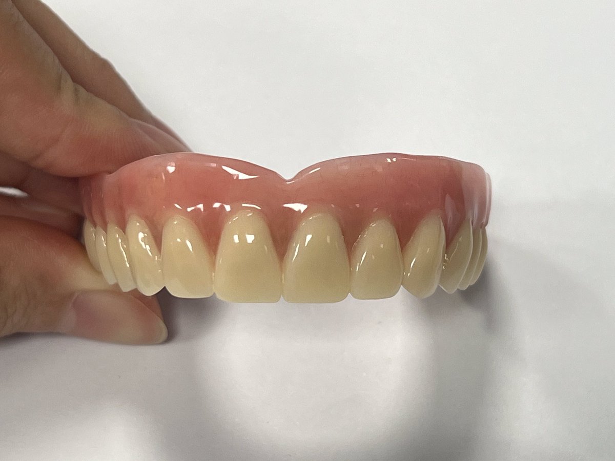 CosmosDentalCN's tweet image. Titanium-bar with overdenture

made by Cosmos Dental Technology

#overdenture #implant #titaniumbar #denture #dental