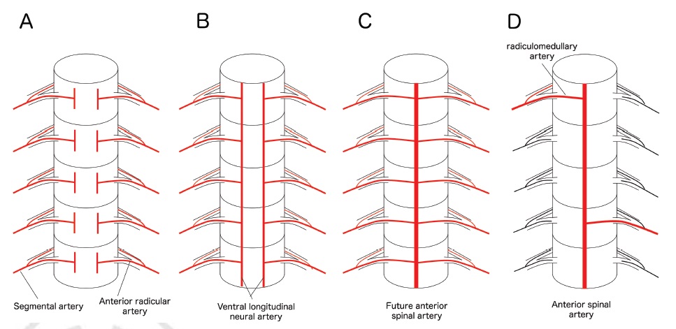 Taka_Tamaso's tweet photo. My latest review article is published online in Seminars in Neurology.
"Functional Vascular Anatomy and Arteriovenous Shunts of the Spine"
https://t.co/w42G3A4K0o

#NNAC #FANconference #Neuroangiology #spine #arteriovenous #shunt https://t.co/OgyRPYQ2Wm