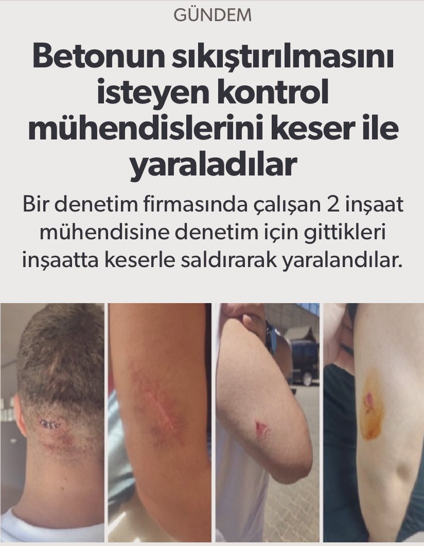 MÜHENDİSLER DARP EDİLİYOR!!!

Ülkemizde bir daha felaketler yaşanmasın diye sorumluluklarını yerine getirmeye çalışan değerli meslektaşlarımız  keserle saldırıya uğradılar. Çok geçmiş olsun.

yesilsivasligazetesi.com/betonun-sikist…