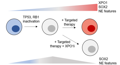 Excited to see the latest <a href="/charlesrudin/">Charlie Rudin</a> lab paper published in <a href="/ScienceTM/">Science Translational Medicine</a>: "Exportin 1 inhibition prevents neuroendocrine transformation through SOX2 down-regulation in lung and prostate cancers". #lungcancer #prostatecancer #SCLC #lineageplasticity science.org/doi/10.1126/sc…