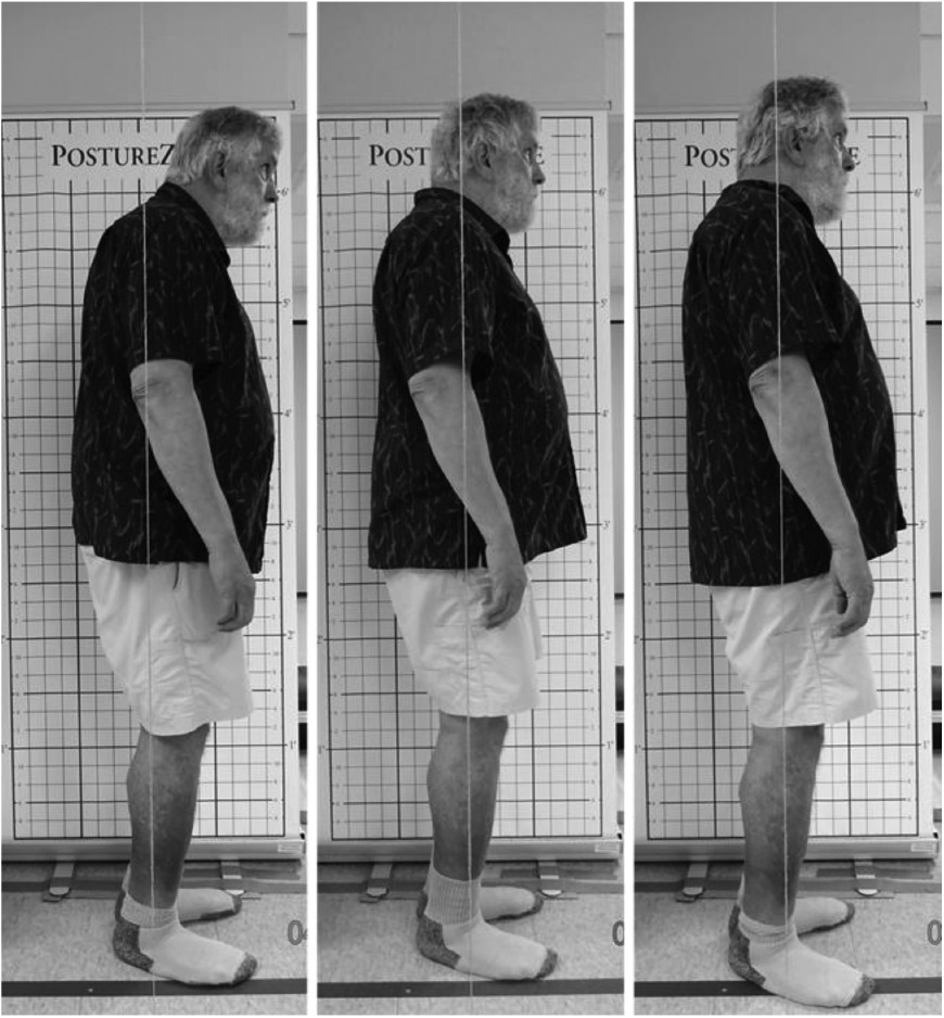 JGPTonline's tweet image. A recent pilot study suggests manual therapy and exercise applied to older adults shows promise for improvement in measures of posture and functional performance in a clinically feasible 4-week time frame.

tinyurl.com/4bfk93rc

#physicaltherapy #PTTransforms #ChoosePT