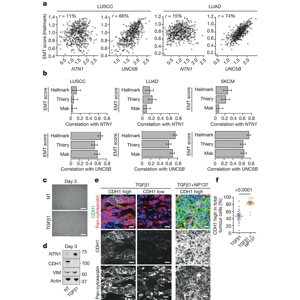 NaturePortfolio's tweet photo. The results of a study in @Nature identify a pharmacological strategy for targeting epithelial-to-mesenchymal transition in cancer, opening up novel therapeutic interventions for anti-cancer therapy. https://t.co/jMEYKZWnNu https://t.co/TyL46peQzY