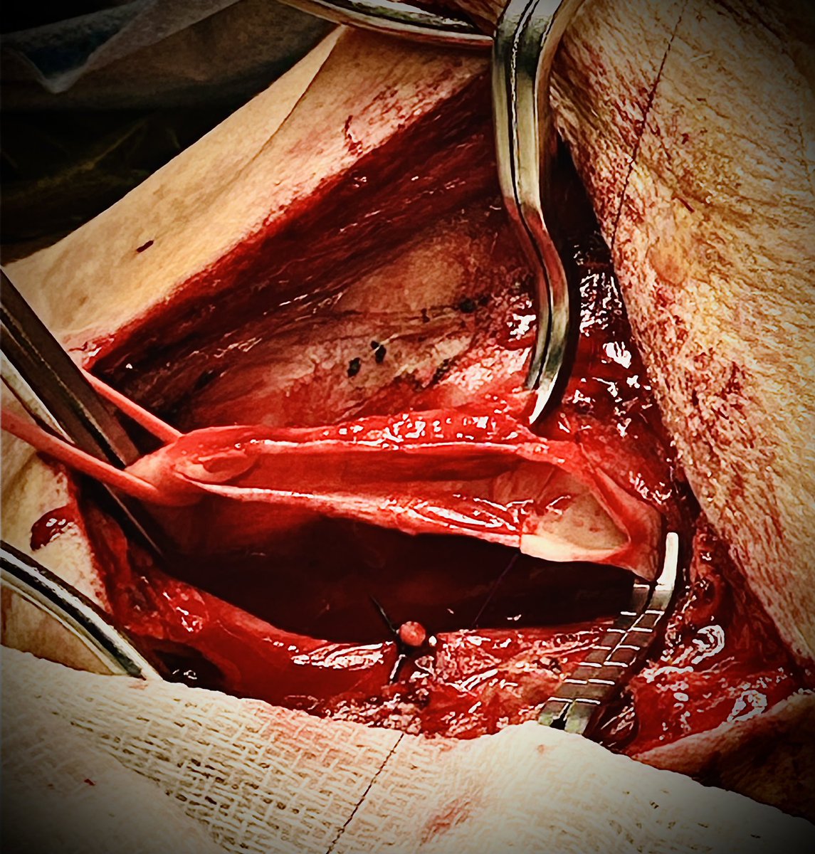 frank arko tweet media