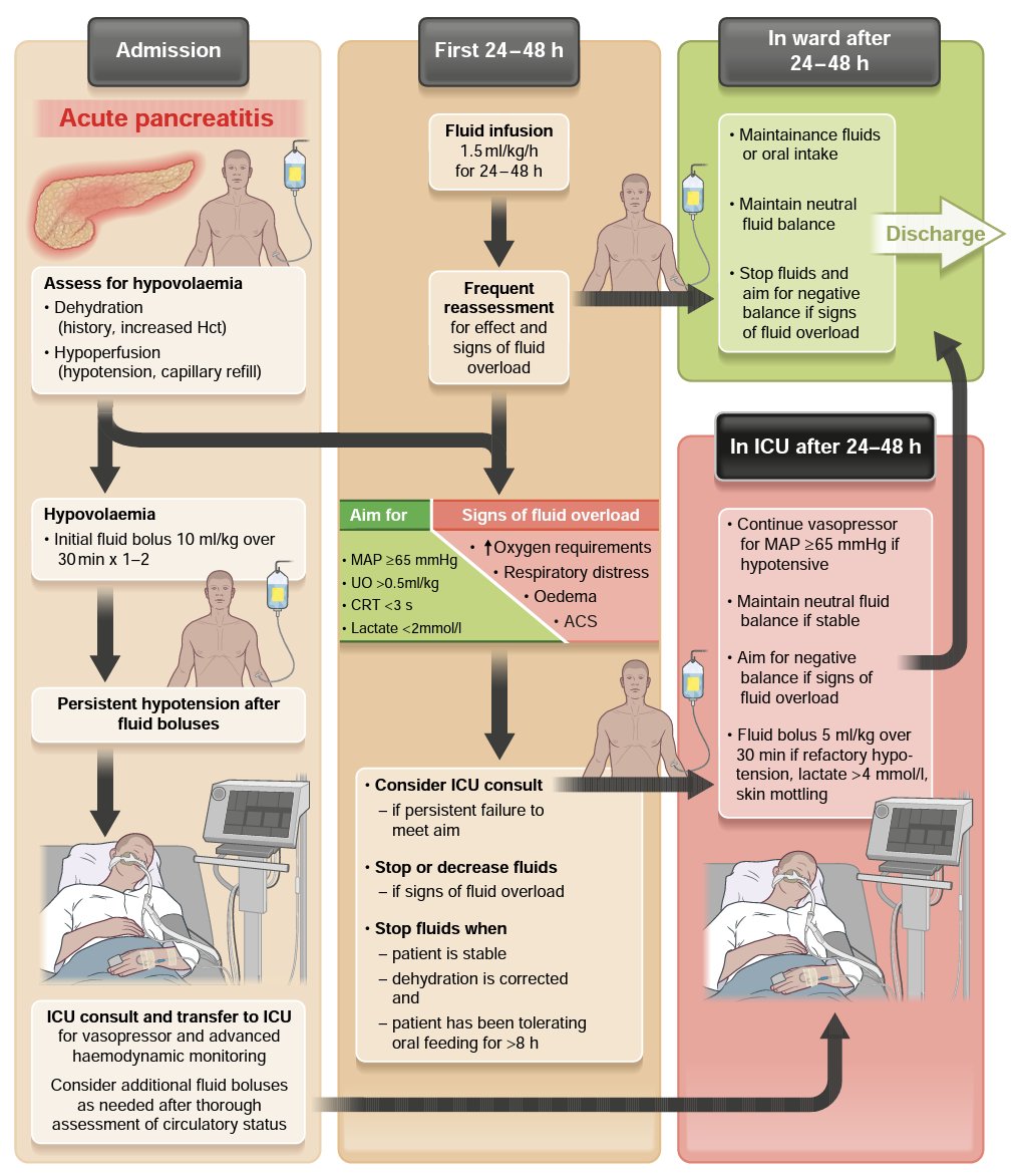 YukiKotani5's tweet photo. Fluid therapy in acute pancreatitis💧
#WATERFALLtrial: Aggressive fluid therapy⬆️fluid overload
A recent meta-analysis: Aggressive fluid therapy⬆️mortality in severe acute pancreatitis
👇Current evidence supports moderate fluid therapy.
🔓https://t.co/xHMfmkMGrm
#FOAMcc https://t.co/nOZk1nqFIq