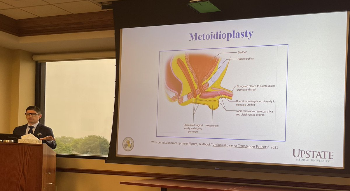 David Abramowitz (@nickelcityuro) on Twitter photo Big thanks to <a href="/UroRecon/">Dmitriy Nikolavsky</a> for giving an amazing grand rounds on gender affirming surgery techniques! Also ty <a href="/UpstateUroRes/">SUNY Upstate Urology Residency</a> for letting us borrow him for the past two days. <a href="/UBUrology/">UB Urology</a> <a href="/SocietyGURS/">GURS</a> Big thanks to <a href="/UroRecon/">Dmitriy Nikolavsky</a> for giving an amazing grand rounds on gender affirming surgery techniques! Also ty <a href="/UpstateUroRes/">SUNY Upstate Urology Residency</a> for letting us borrow him for the past two days. <a href="/UBUrology/">UB Urology</a> <a href="/SocietyGURS/">GURS</a>