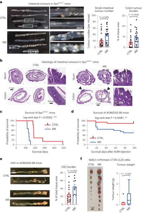 Online now! Methionine restriction-induced sulfur deficiency impairs antitumour immunity partially through gut microbiota dlvr.it/St8yd0