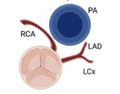 Just out ➡️ Outcomes of Adult Patients With Anomalous RCA #CardioTwitter @fischman_david @mmamas1973 @DrMarthaGulati @ErinMichos @djc795 @DougDrachmanMD @Drroxmehran @SVRaoMD @JGrapsa @iamritu @DLBHATTMD @mirvatalasnag @hvanspall @sbrugaletta @DrJayMohan sciencedirect.com/science/articl…