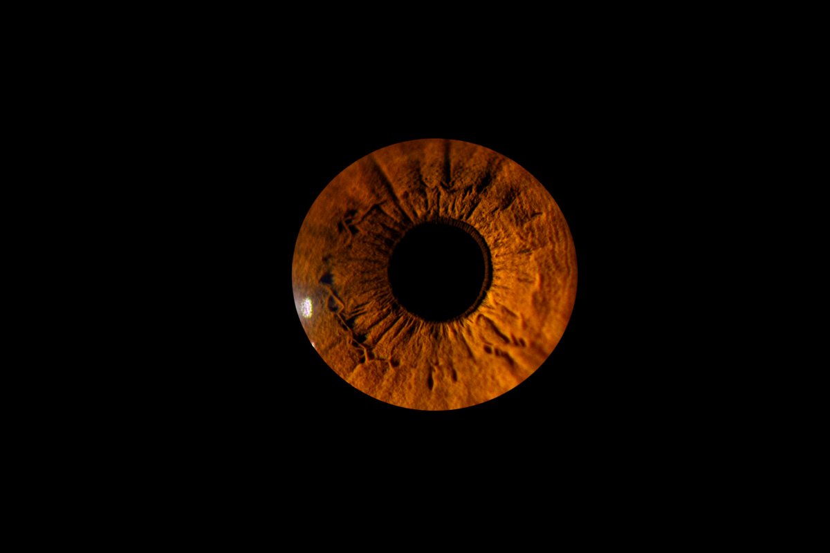 They say the eyes are the windows to the soul. What they don’t tell you is that those windows look like an alien world when looked up close. Stemmed from our recent pupillometry work, this picture of my eye came out of a macro photography pet project.