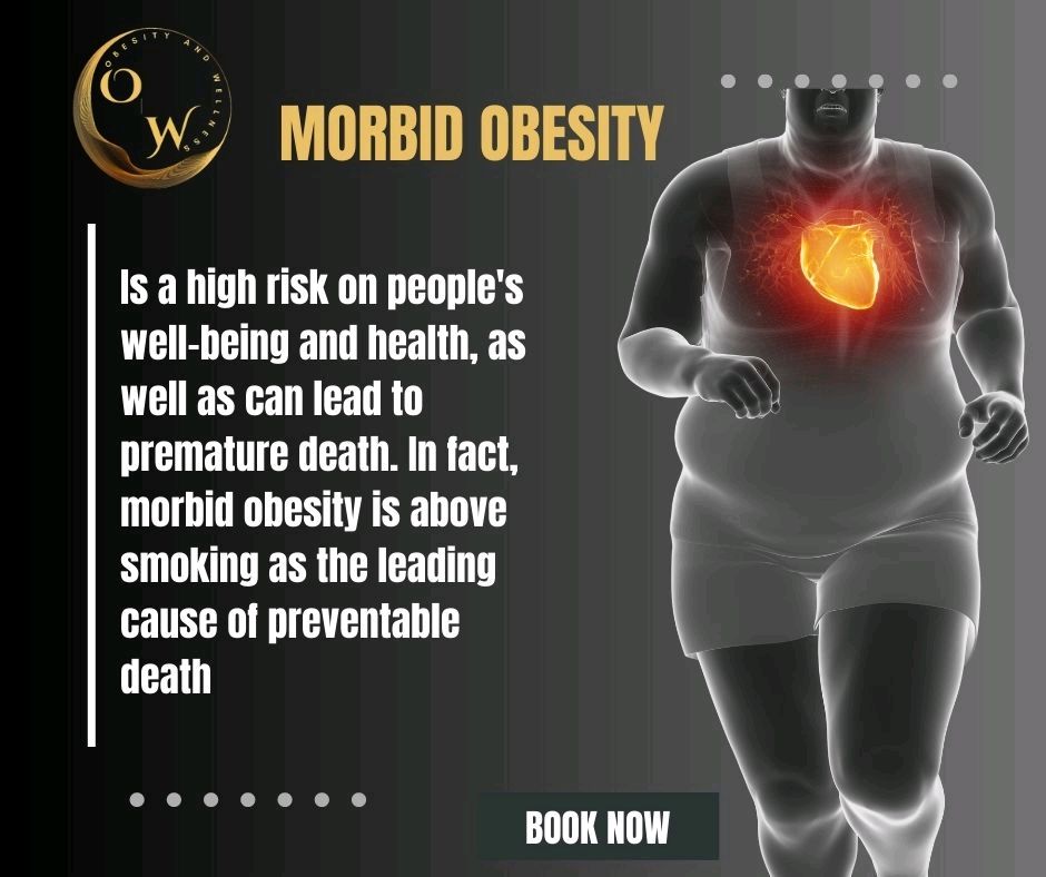 Obesity&Wellness (@ObesityandWelln) / Posts / X