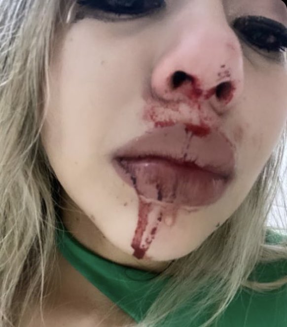 informategyeec's tweet photo. Esta página fue creada, con la intención de difundir, todo tipo de abuso.
Queremos enviar, un abrazo a la distancia a Julissa Ortega.
Advertimos a más mujeres, sobre este sujeto y su comportamiento violento.
#noalaviolenciacontralamujer
Qué esto no quede impune @FiscaliaEcuador https://t.co/KiJKLoa6SO