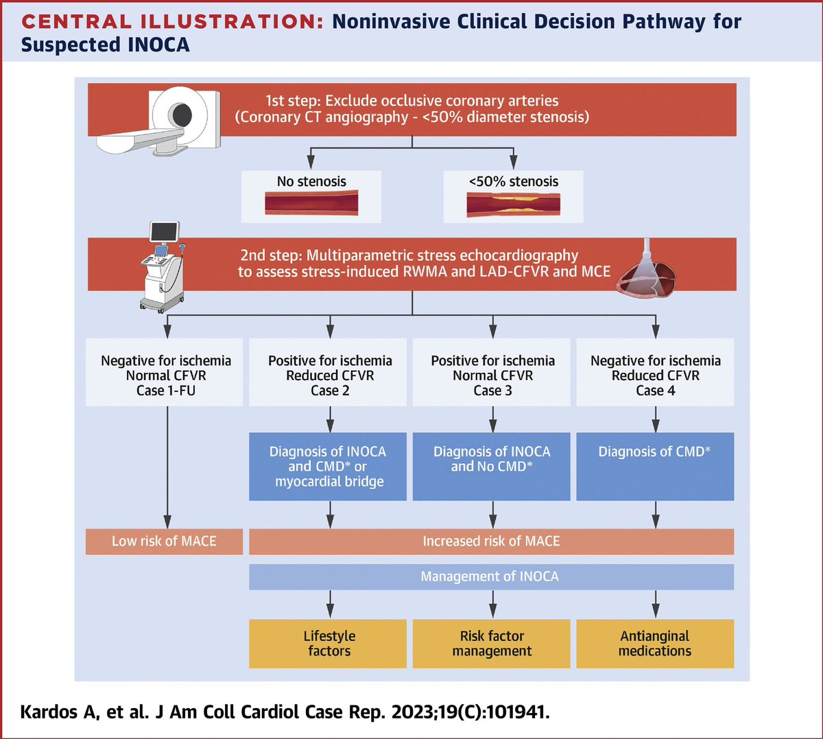 Julia Grapsa MD, PhD (@jgrapsa) on Twitter photo Dr Attila Kardos et al ➡️ #JACCCaseReports educational case series ➡️ multiparametric dobutamine stress echocardiography to differentiate inducible ischemia with obstructive coronary artery disease and INOCA ➡️ jacc.org/doi/10.1016/j.… <a href="/JACCJournals/">JACC Journals</a> <a href="/MinnowWalsh/">Minnow Walsh, MD, MACC</a> <a href="/rafavidalperez/">rafavidalperez</a> Dr Attila Kardos et al ➡️ #JACCCaseReports educational case series ➡️ multiparametric dobutamine stress echocardiography to differentiate inducible ischemia with obstructive coronary artery disease and INOCA ➡️ jacc.org/doi/10.1016/j.… <a href="/JACCJournals/">JACC Journals</a> <a href="/MinnowWalsh/">Minnow Walsh, MD, MACC</a> <a href="/rafavidalperez/">rafavidalperez</a>