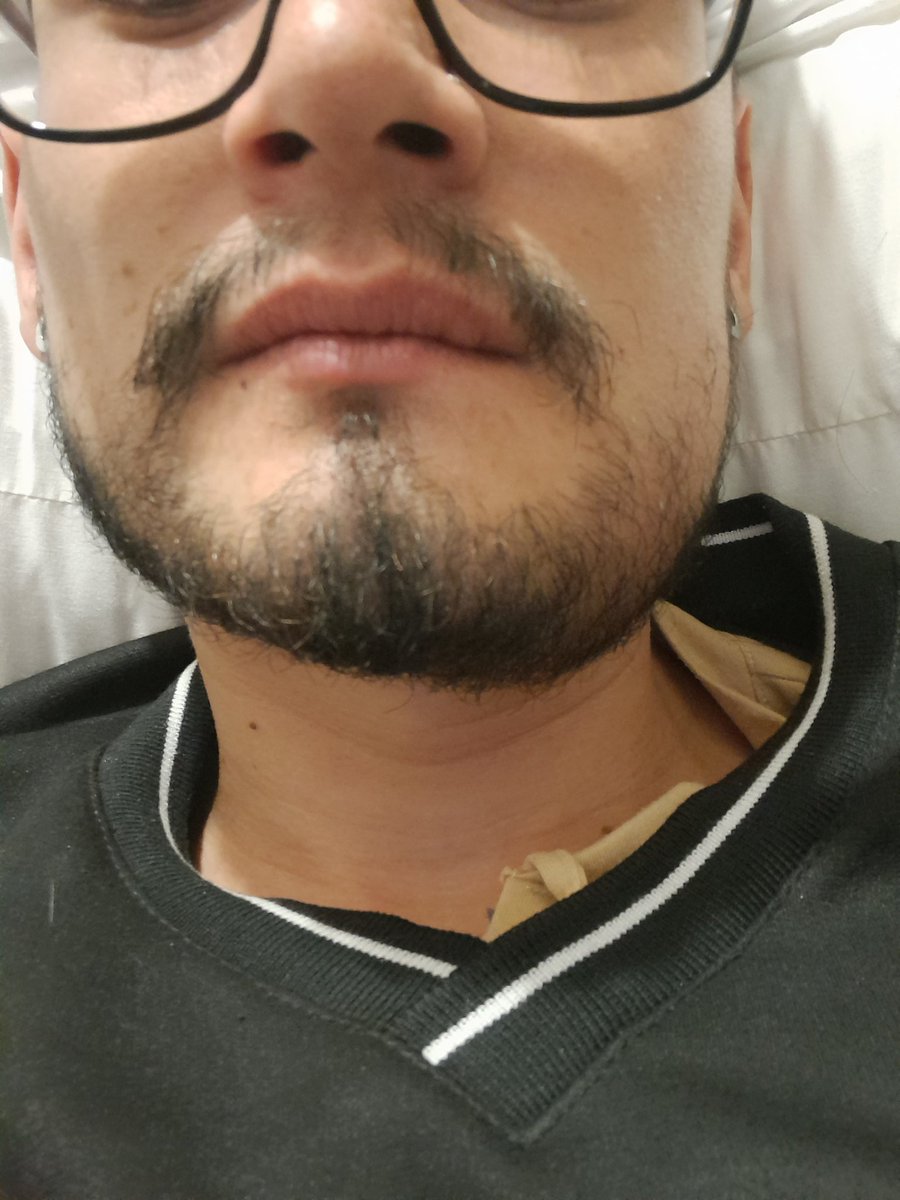 Nafie me pregunto, pero asi voy despues d mi cirugia, ya no me duele pero sigo con cara de kiko dijo una amiga 😂😂🫣