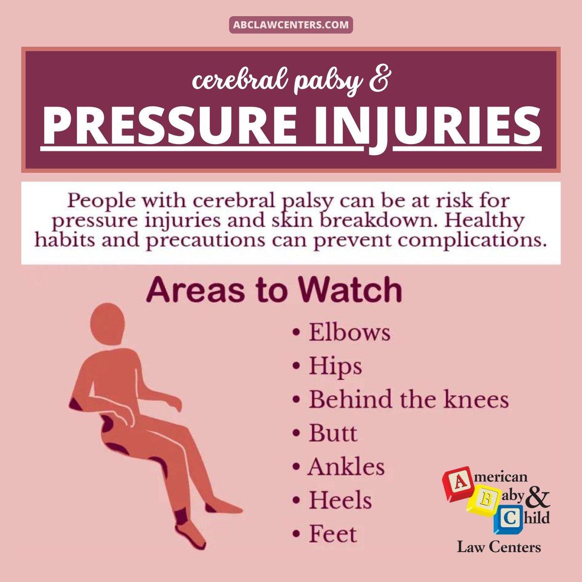 abclawcenters's tweet image. Pressure injuries are caused by blood flow being cut off to the skin when it is compressed between bone and something hard, like a seat, bed, or brace.
abclawcenters.com/cerebral-palsy… #pressureinjuries #cerebralpalsy #skincondition