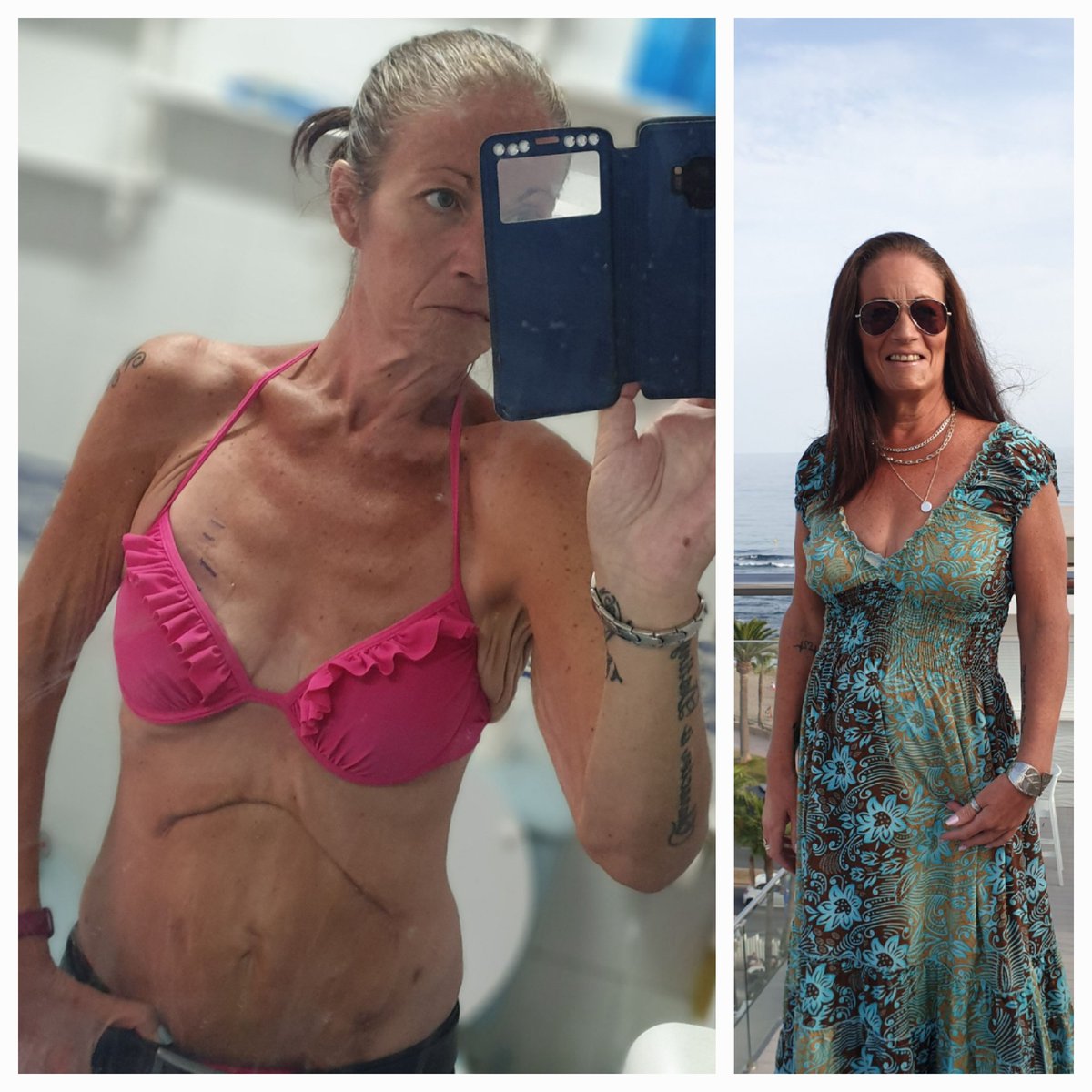 WarriorWhipple's tweet photo. @BBCTheOneShow great show guys. Im after your help. I'm writing a tiny blog https://t.co/ipvYLaled5 it's my heath journey resulting in whipple surgery,the main goal is to help others, and for my own mental health.Please have a read ,a retweet would be amazing.Much love Julia xx❤️ https://t.co/Duwz6FEB4o