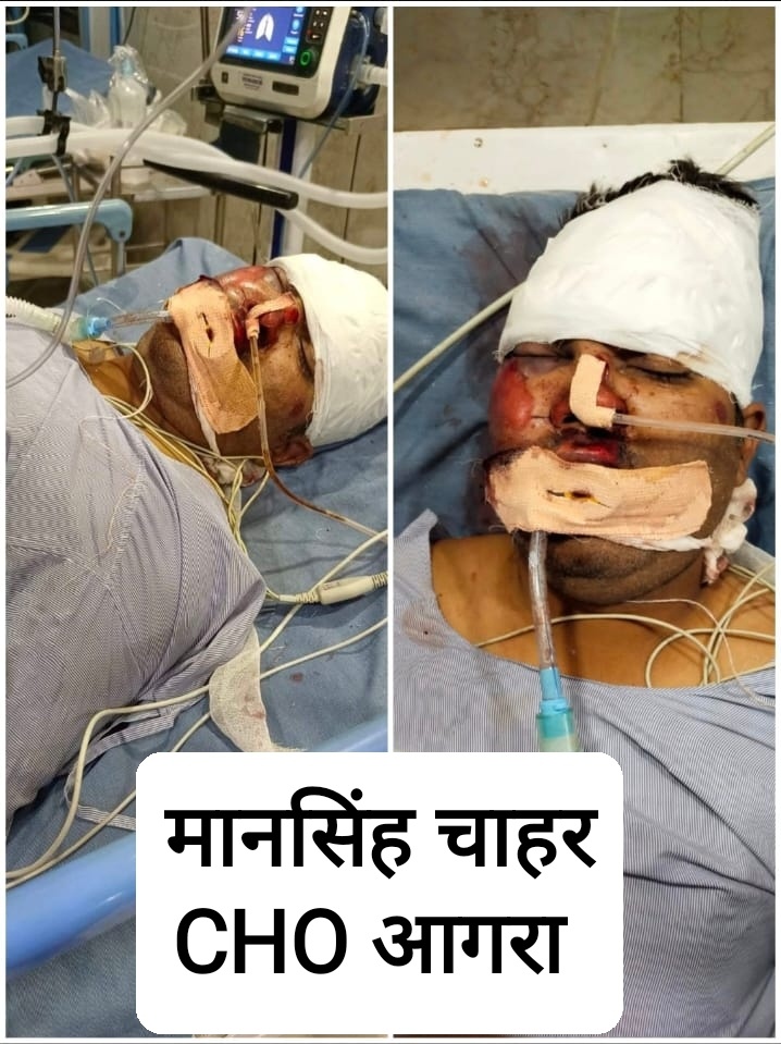 officer_cho's tweet photo. स्वास्थ्य विभाग के सबसे मज़बूत पिलर #CHOs आए दिन गम्भीर दुर्घटना के शिकार हो रहे हैं।
डिप्टी सीएम माननीय @brajeshpathakup जी से निवेदन है सभी सीएचओ के लिए आयुष्मान कार्ड एवं बीमा पॉलिसी तुरंत लागू करे।
#बीमा_पॉलिसी_लागू_करो
@Sen2Partha @nhm_up
@myogiadityanath @vishalchauhan_1 https://t.co/9r07SvMLic