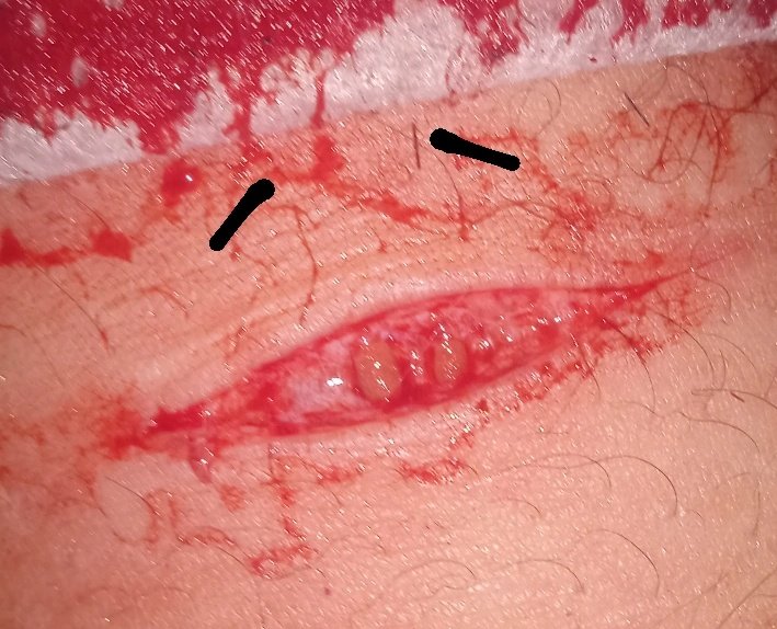 mutilandose's tweet photo. una carita feliz con dientes https://t.co/lc3vNsjpiQ