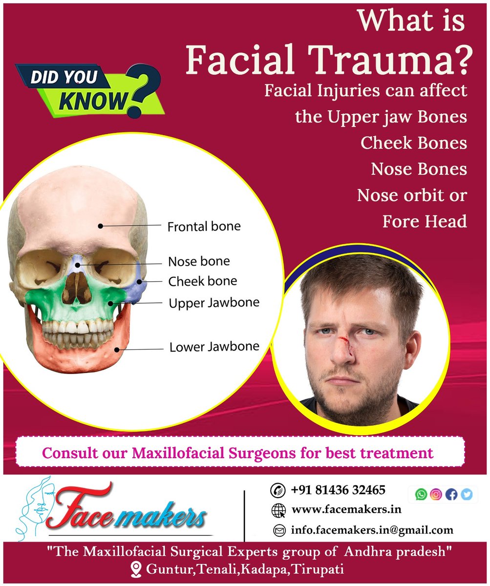 What is Facial Trauma ?
For appointment :+ 91 81436 32465
#facialtrauma #facialinjuries #cheekbones #jawbones #orthognathicsurgery #aestheticprofile #bestmaxillofacialsurgeon
#bestcosmeticsurgeon #NonHealingUlcers #redpatchesonthemouth #bestoralsurgeon