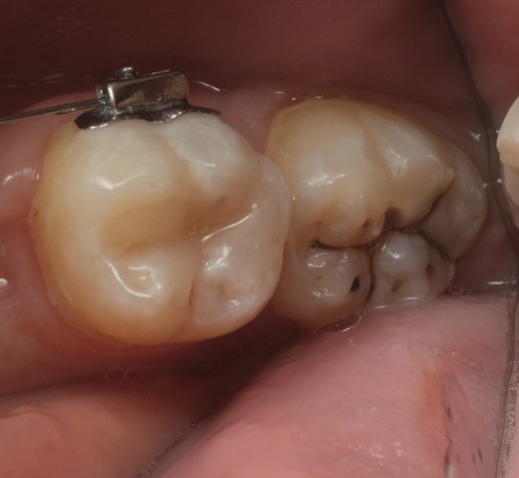 ryanjusuf's tweet image. #directcomposite