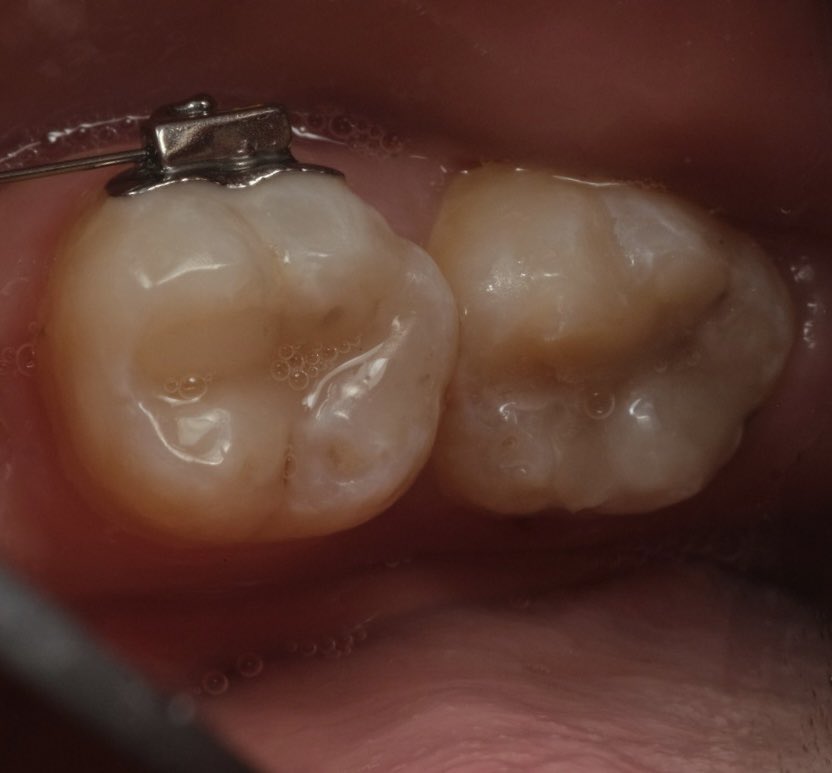 ryanjusuf's tweet image. #directcomposite