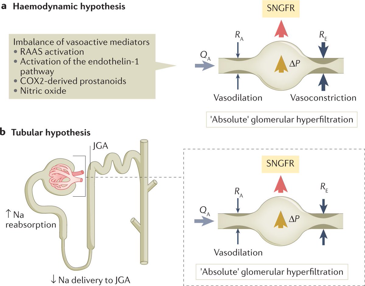 Potential origins of obesity-related glomerular hyperfiltration go.nature.com/35WxifA