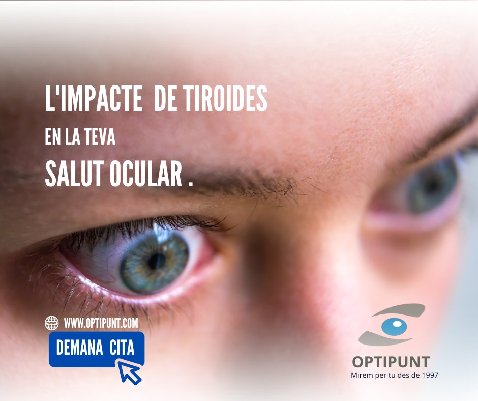 Optipunt tweet media