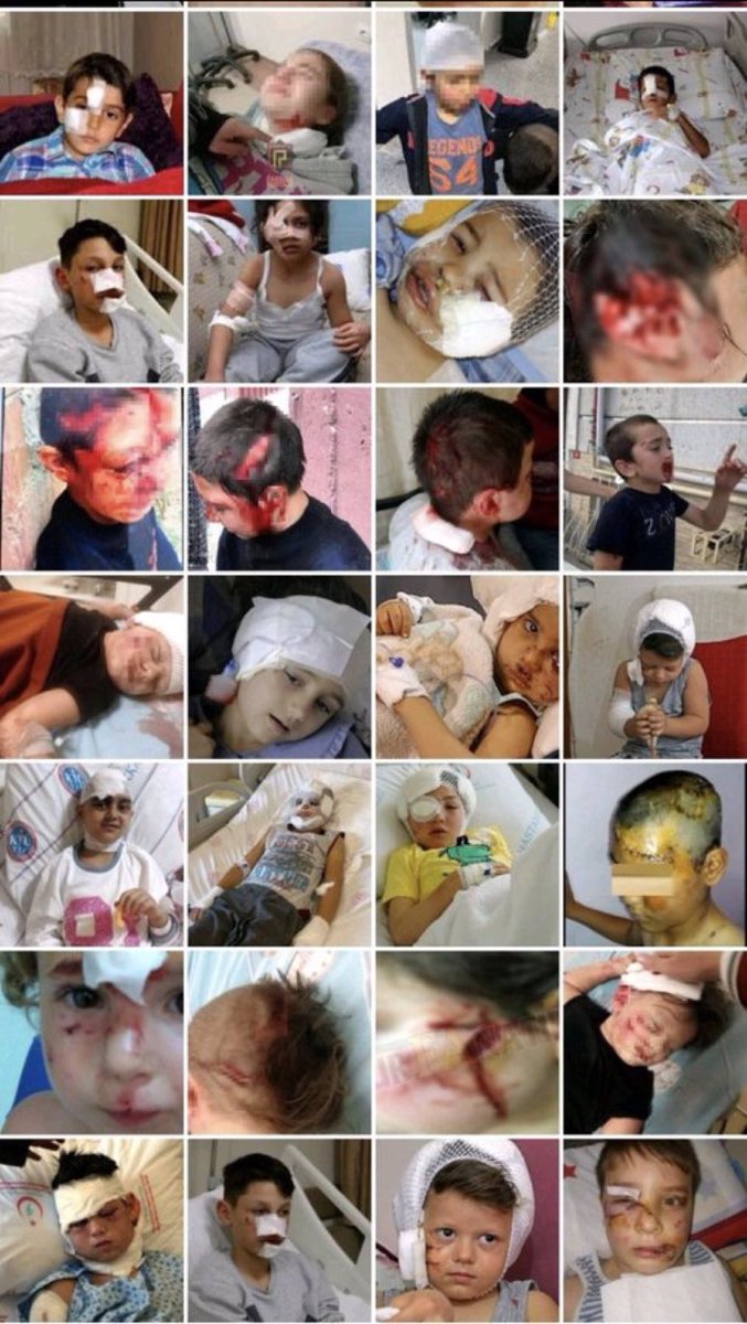 KoNNiChiiWa_'s tweet image. Gerçekten şu köpek sorunun çözülmesi için ne bekleniyor anlamak çok zor
Akıl işi değil
Amazon ormanlarında yaşayan kabileler daha güvenli 1 ortamda yaşıyor
İnsanların organize olup ellerinde av tüfekleriyle sokaklarda sürek avına çıkmasınımı bekliyorsunuz
@akparti
#katilköpekler