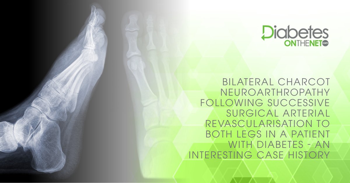 dotn_uk's tweet photo. An unusually good blood supply and peripheral neuropathy are reportedly accepted prerequisites for the pathogenesis of Charcot neuroarthropathy (CN) in people with diabetes. Learn more here: https://t.co/f2GVJdZK5j #DOTN https://t.co/1BFAaAeR57