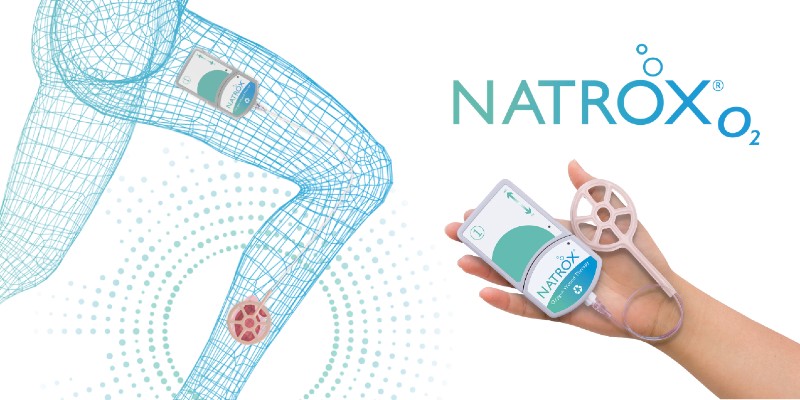 An innovative medical device which supports wound healing with oxygen is gaining worldwide traction. @Natroxwoundcare CEO Craig Kennedy says its NATROX® O₂ topical oxygen therapy device is primed to go truly global after “five years of prep work” 🌎 businesscloud.co.uk/news/natrox-wo…