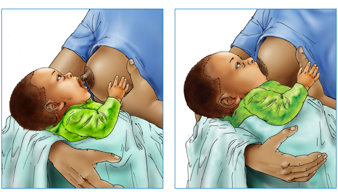 NutritionistsRw's tweet photo. While #breastfeeding, be conscious about attachment !
@RwandaHealth @RBCRwanda @unicefrw @society_uganda @KamaraDaniel3 @nyakanathan @EBatetiwabo @specialeah @karemerajoseph8 https://t.co/b7kaasr1q1