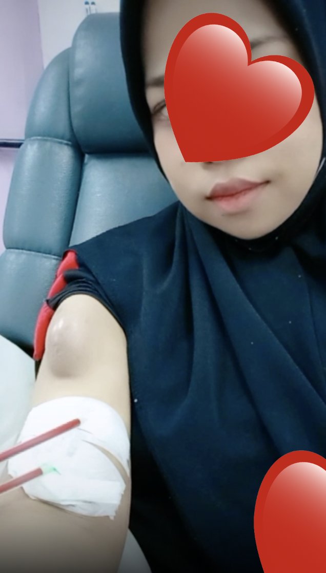 MarhaenMy's tweet photo. Nama: Nur Syarfa
Umur: 27 tahun
Penyakit: SLE LUPUS, Darah Tinggi, End-Stage Renal Disease

Start sakit 2012. Demam on off, muntah darah, muka bertompok &amp; rambut gugur. Bengkak badan &amp; pergi check dapat tau SLE Lupus dah serang buah pinggang. Now dapat tahu ada thyroid. Bantu RT. https://t.co/voadH06Agz