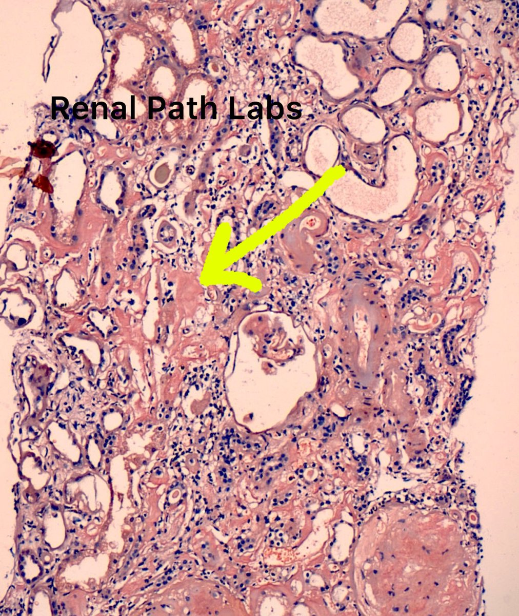 Renal Path Labs tweet media